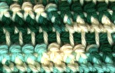 Close Up of stitches