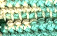 Close Up of stitches